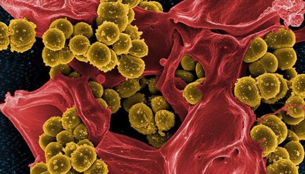 Bakterilerin 'ölüm çığlığı' diğer bakterileri uyarıyor