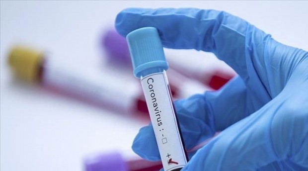 Koronavirüs verileri açıklandı: 7 can kaybı, bin 534 yeni vaka