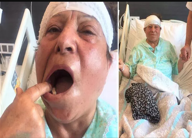 Ağzındaki bütün sağlam azı dişlerini çektirdi! 'Delirten hastalığı' 70 yaşında yendi
